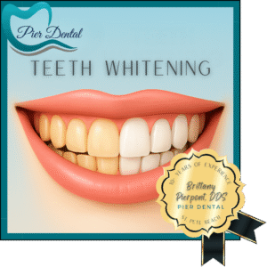Pier Dental Branded Service Image for Teeth Whitening in St. Pete Beach, Florida. It highlights that Brittany Pierpont, DDS. has 10+ Years as a local Dentist